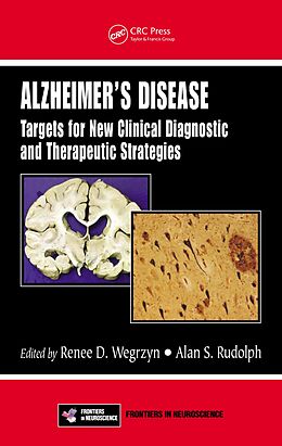 E-Book (pdf) Alzheimer's Disease von 