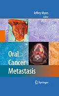 E-Book (pdf) Oral Cancer Metastasis von Jeffrey Meyers