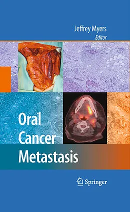 E-Book (pdf) Oral Cancer Metastasis von Jeffrey Meyers