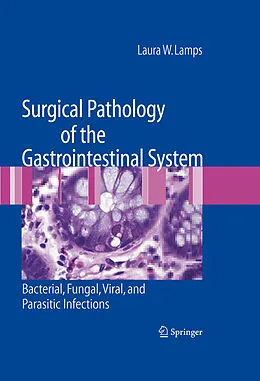 E-Book (pdf) Surgical Pathology of the Gastrointestinal System: Bacterial, Fungal, Viral, and Parasitic Infections von Laura W. Lamps
