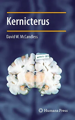 E-Book (pdf) Kernicterus von David W. McCandless