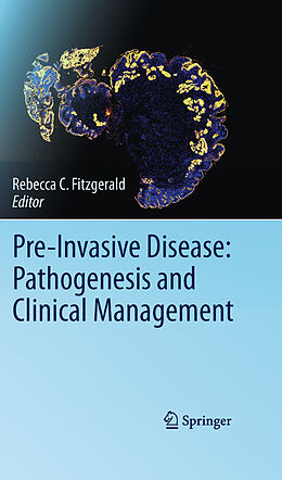Fester Einband Pre-Invasive Disease: Pathogenesis and Clinical Management von 