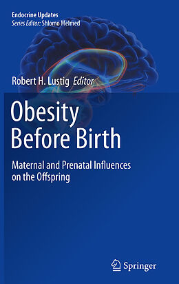 E-Book (pdf) Obesity Before Birth von Robert H Lustig