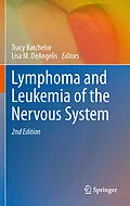 E-Book (pdf) Lymphoma and Leukemia of the Nervous System von Tracy Batchelor, Lisa M. DeAngelis