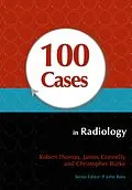 PDF 100 Cases in Radiology von Robert Thomas, James Connelly, Christopher Burke