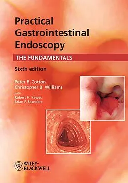 E-Book (pdf) Practical Gastrointestinal Endoscopy von Peter B. Cotton, Christopher B. Williams