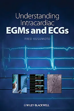 E-Book (pdf) Understanding Intracardiac EGMs and ECGs von Fred M. Kusumoto