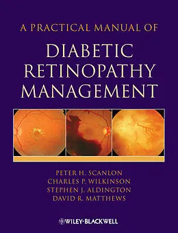 E-Book (pdf) A Practical Manual of Diabetic Retinopathy Management von Peter Scanlon, Stephen Aldington, Charles Wilkinson