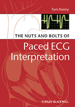 E-Book (pdf) The Nuts and bolts of Paced ECG Interpretation von Tom Kenny