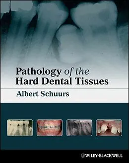 E-Book (pdf) Pathology of the Hard Dental Tissues von Albert Schuurs