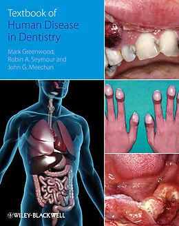 E-Book (pdf) Textbook of Human Disease in Dentistry von Mark Greenwood, Robin Seymour, John Meechan