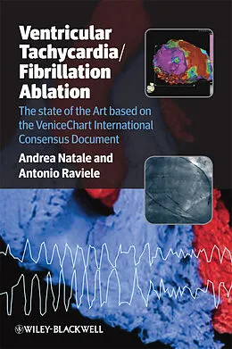 E-Book (pdf) Ventricular Tachycardia / Fibrillation Ablation von Andrea Natale, Antonio Raviele