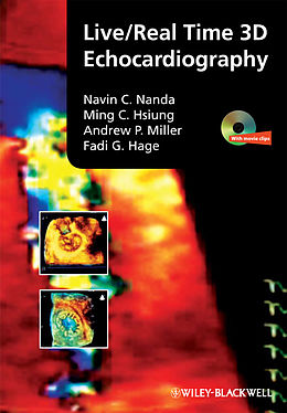 eBook (pdf) Live/Real Time 3D Echocardiography de Navin Nanda, Ming Chon Hsiung, Andrew P. Miller