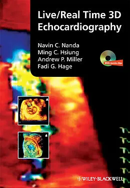 E-Book (pdf) Live/Real Time 3D Echocardiography von Navin Nanda, Ming Chon Hsiung, Andrew P. Miller