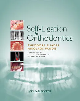 E-Book (pdf) Self-Ligation in Orthodontics von Theodore Eliades, Nikolaos Pandis