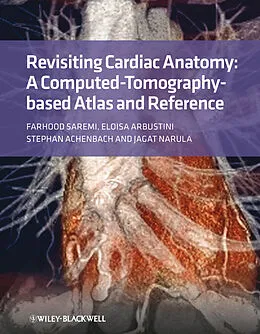 E-Book (pdf) Revisiting Cardiac Anatomy von Farhood Saremi