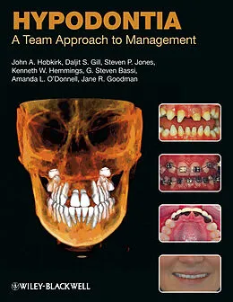 E-Book (epub) Hypodontia von John A. Hobkirk, Daljit S. Gill, Steven P. Jones
