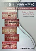 E-Book (pdf) Toothwear von Farid Khan, William George Young