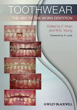 E-Book (pdf) Toothwear von Farid Khan, William George Young
