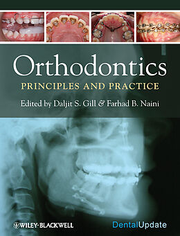 eBook (epub) Orthodontics de Daljit S. Gill, Farhad B. Naini