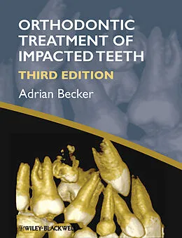 E-Book (pdf) Orthodontic Treatment of Impacted Teeth von Adrian Becker