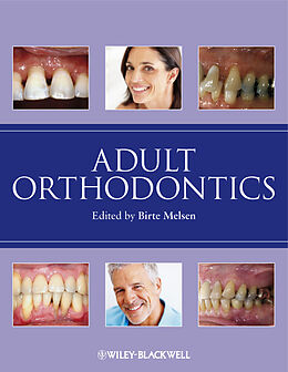 eBook (pdf) Adult Orthodontics de 