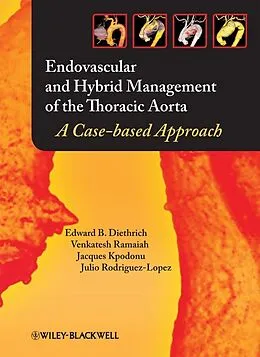 E-Book (epub) Endovascular and Hybrid Management of the Thoracic Aorta von Edward B. Diethrich, Venkatesh Ramaiah, Jacques Kpodonu