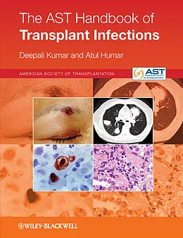 E-Book (epub) AST Handbook of Transplant Infections von Deepali Kumar, Atul Humar