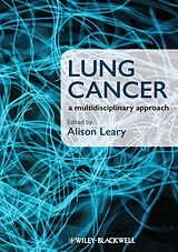 eBook (pdf) Lung Cancer de 