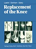 E-Book (pdf) Replacement of the Knee von R. S. Laskin, R. A. Denham, A. G. Apley