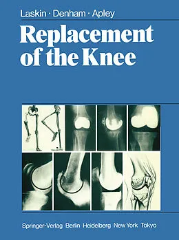 E-Book (pdf) Replacement of the Knee von R. S. Laskin, R. A. Denham, A. G. Apley