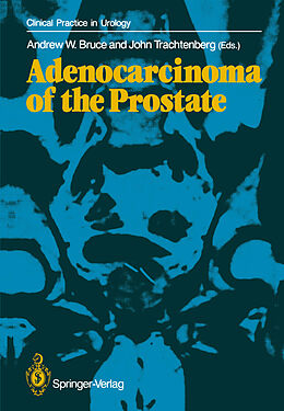 Kartonierter Einband Adenocarcinoma of the Prostate von 