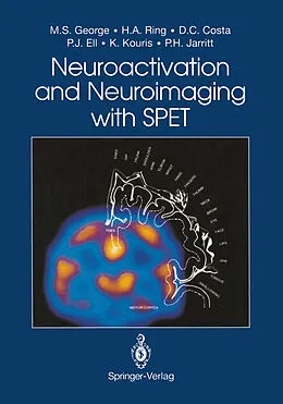 E-Book (pdf) Neuroactivation and Neuroimaging with SPET von Mark S. George, Howard A. Ring, Durval C. Costa