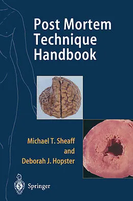 E-Book (pdf) Post Mortem Technique Handbook von Michael T. Sheaff, Deborah J. Hopster