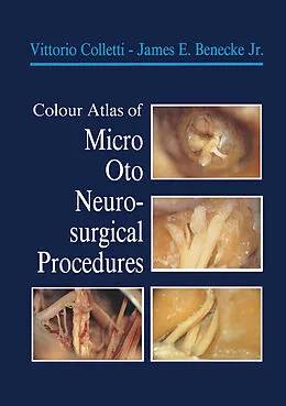 E-Book (pdf) Colour Atlas of Micro-Oto-Neurosurgical Procedures von Vittorio Colletti, James E. Jr. Benecke