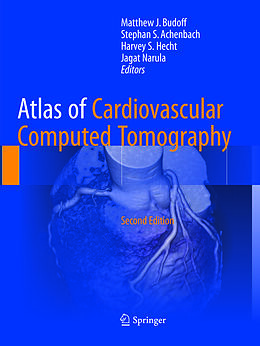 Couverture cartonnée Atlas of Cardiovascular Computed Tomography de 