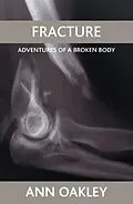 E-Book (epub) Fracture von Ann Oakley