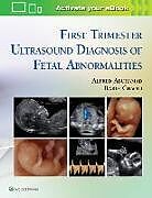 Fester Einband First Trimester Ultrasound Diagnosis of Fetal Abnormalities von Alfred Abuhamad, Rabih Chaoui