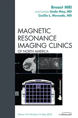ePUB Breast MRI, An Issue of Magnetic Resonance Imaging Clinics von Linda Moy, Cecilia L. Mercado