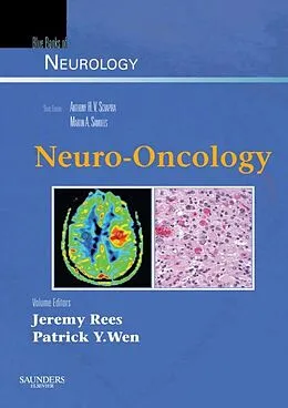 E-Book (epub) Neuro-Oncology von Jeremy Rees, Patrick Y Wen