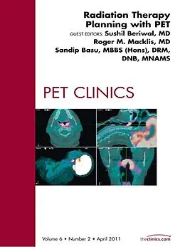 E-Book (epub) Radiation Therapy Planning, An Issue of PET Clinics von Sushil Beriwal MD