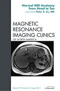 E-Book (epub) Normal MR Anatomy, An Issue of Magnetic Resonance Imaging Clinics von Peter S. Liu MD