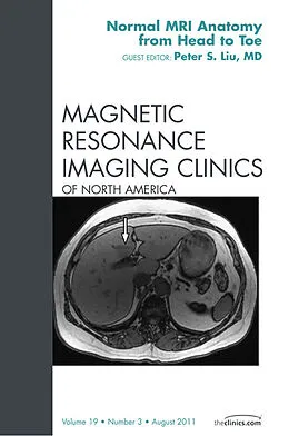 E-Book (epub) Normal MR Anatomy, An Issue of Magnetic Resonance Imaging Clinics von Peter S. Liu MD