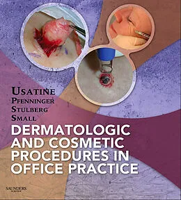 E-Book (epub) Dermatologic and Cosmetic Procedures in Office Practice E-Book von Richard P. Usatine, John L. Pfenninger, Daniel L. Stulberg