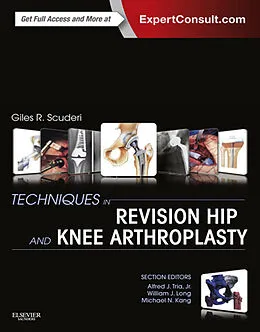 E-Book (epub) Techniques in Revision Hip and Knee Arthroplasty E-Book von Giles R Scuderi MD