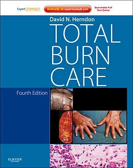 E-Book (epub) Total Burn Care von David N. Herndon