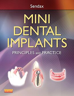 eBook (epub) Mini Dental Implants de Victor Sendax