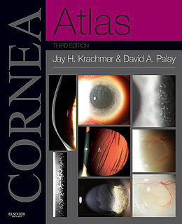 eBook (epub) Cornea Atlas E-Book de Jay H. Krachmer MD, David A Palay MD