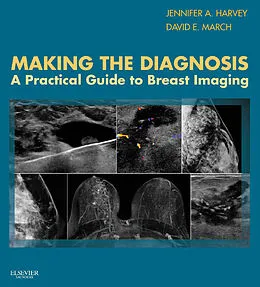 E-Book (epub) Making the Diagnosis: A Practical Guide to Breast Imaging E-Book von Facr Harvey MD, David E March MD