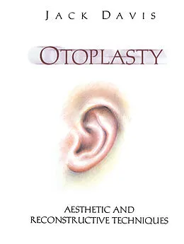 E-Book (pdf) Otoplasty von Jack Davis